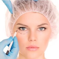 Blefaroplastia cirugia de parpados cali